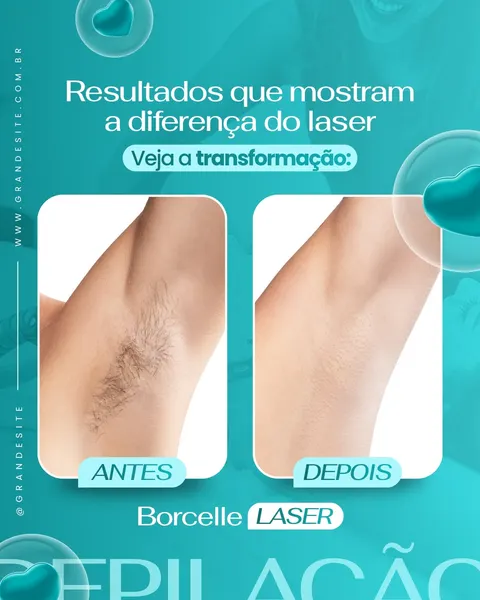 Post para Instagram de clínica de estética exibindo um comparativo "Antes e Depois" de depilação a laser nas axilas. O lado "Antes" mostra pelos densos, e o "Depois" exibe pele lisa e sem pelos, com fundo azul-petróleo e elementos gráficos sutis.