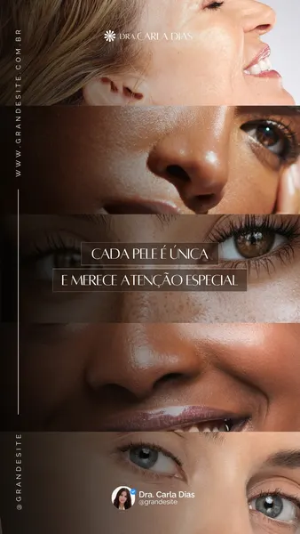 Cada Pele É Única Clínica Dermatológica Moderno Marrom E Branco Story Do Instagram