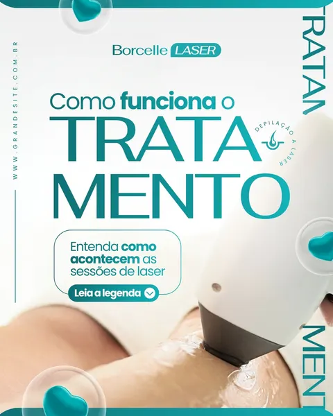 Post de Instagram com fundo branco e detalhes em azul claro, apresentando um aparelho de depilação a laser em ação em uma perna. O título 'Como funciona o TRATAMENTO' em destaque, com subtítulo 'Entenda como acontecem as sessões de laser'.
