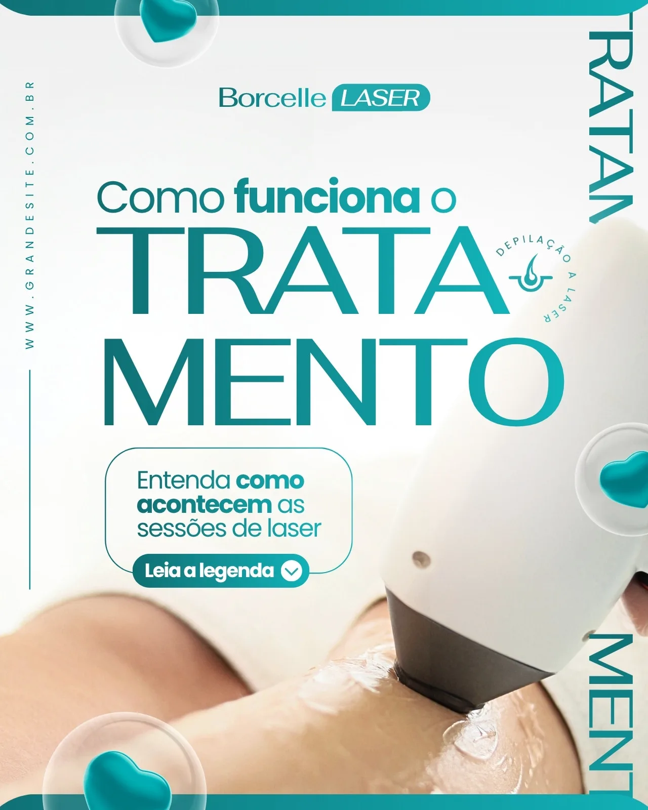 Post de Instagram para clínica de estética com fundo branco e detalhes em azul turquesa. Destaca o título 'Como funciona o TRATAMENTO' com um aparelho de depilação a laser em ação em uma perna. Inclui o logo 'Borchelle LASER' e um botão 'Leia a legenda'.