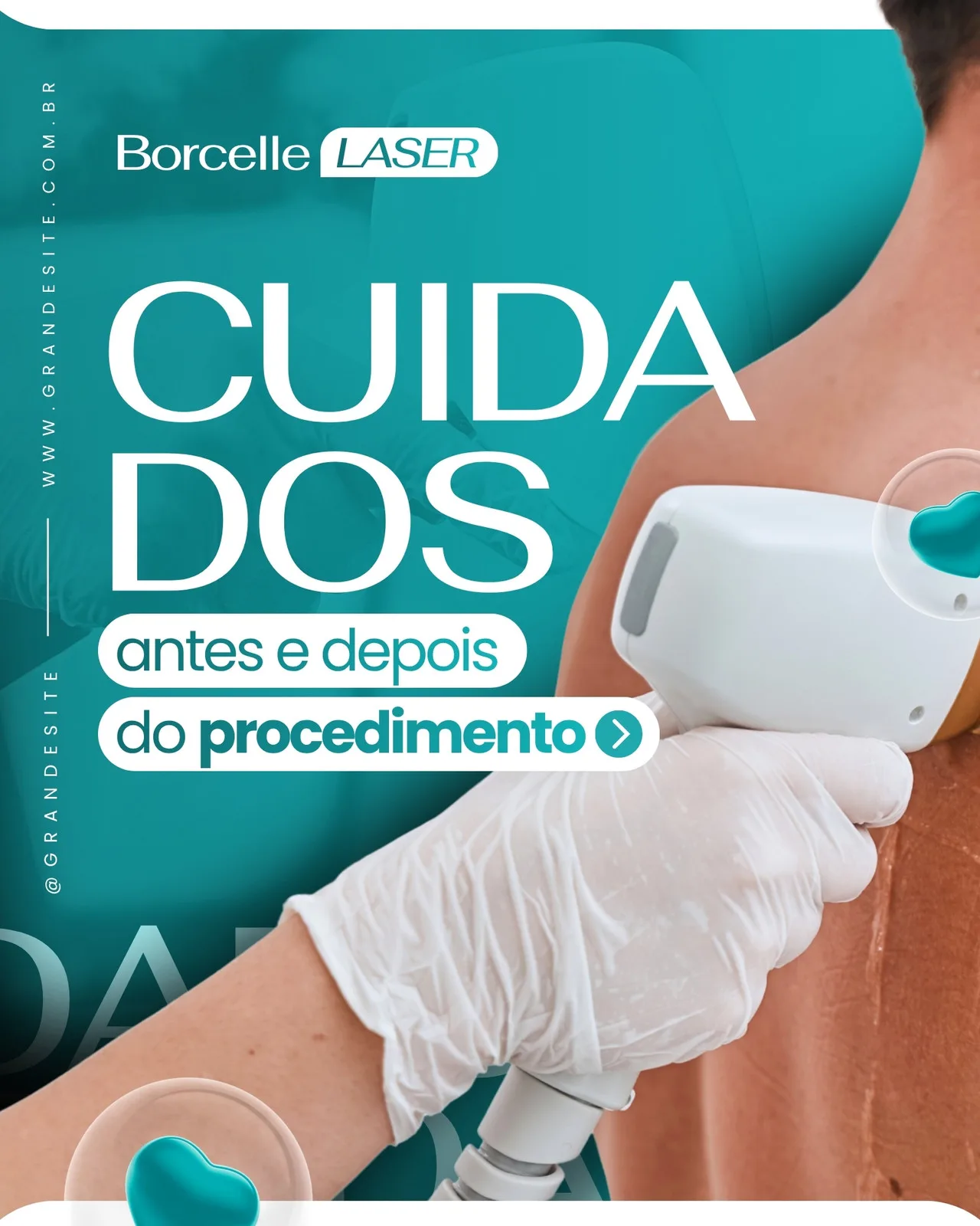 Close-up de um profissional de estética usando luvas brancas e um aparelho de laser em um paciente. O post tem fundo azul-petróleo com texto branco 'CUIDADOS antes e depois do procedimento' e o logo 'Borchelle LASER'.