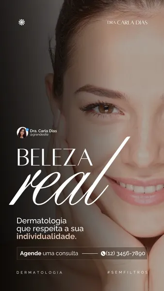 Close-up do rosto de uma mulher com pele impecável em um Story de Instagram para clínica dermatológica. O template em tons de marrom e branco exibe a frase 'Beleza Real' e um botão para agendar consulta, com o nome da Dra. Carla Dias.