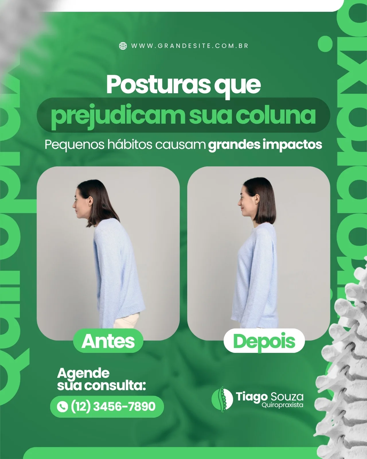 Template de post para Instagram com fundo verde e branco, destacando 'Posturas que prejudicam sua coluna'. Apresenta duas fotos de uma mulher: uma com postura incorreta (antes) e outra com postura correta (depois). Inclui informações de contato e logo de quiropraxia.